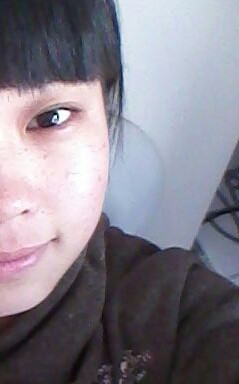 新疆乌鲁木齐去除雀斑的方法是什么