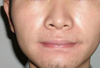 新疆乌鲁木齐脱胡子价格是多少