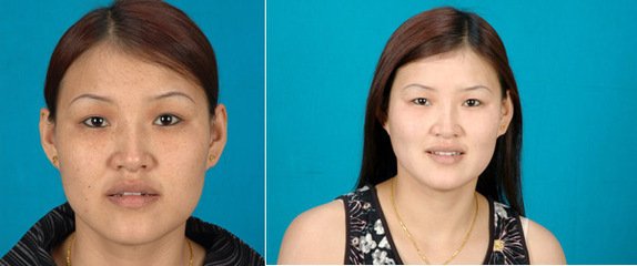 祛斑什么方法最简单